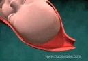 Doğum'um 3D simülasyonu..