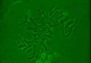 HÜCRE BÖLÜNMESİ MİTOZ (elektron mikroskop görüntüsü )