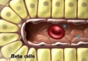 İnsülin mekanizması, Tip 1 ve Tip 2 Diabet -www.stetuskop.com