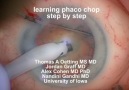 learning phaco chop step by step [HQ]