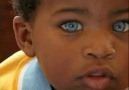 Milyarda Bir '' Siyahi Mavi Gözlü Bebek ''