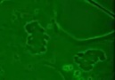 mitoz hücre bölünmesi(elektron mikroskobu)